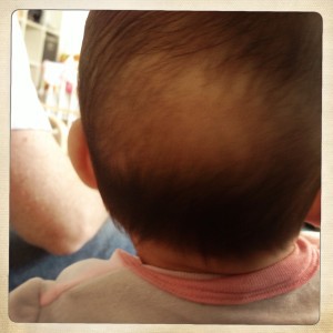 chute-cheveux-grossesse-accouchement