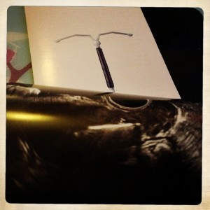 pose-sterilet-gyneco